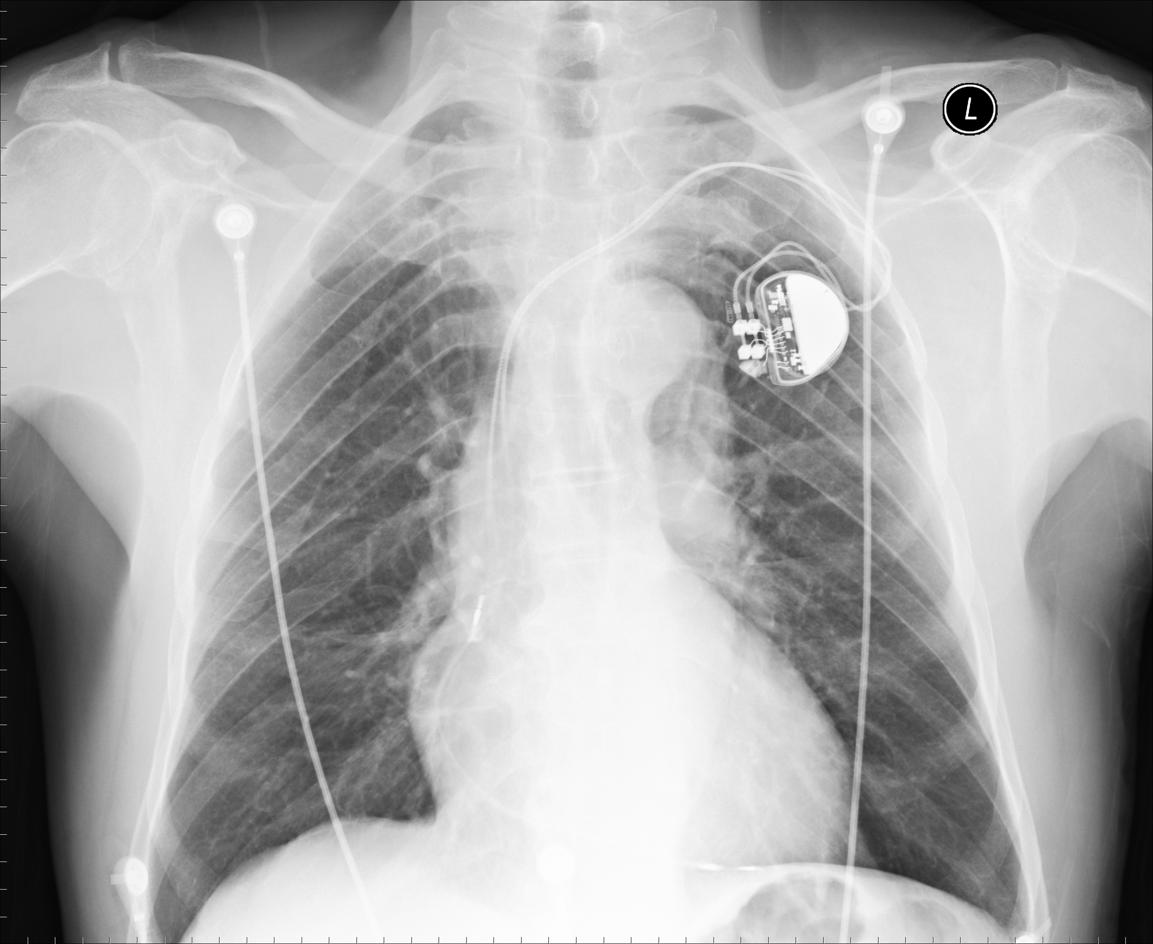 Medical Device Manufacturing
